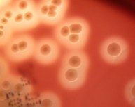 group a streptococci