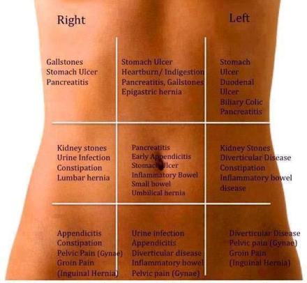 Abdominal Pain Differential